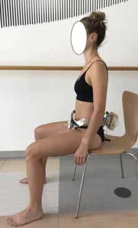 DNS Brace přístroj k měření aktivity břišní stěny. Fig. 2. DNS Brace device to measure activity of the abdominal wall.