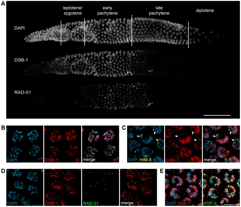 DSB-1 localizes to chromosomes during early meiotic prophase.