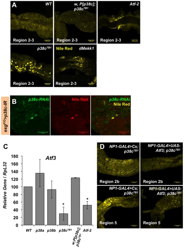 p38c and Atf3 function in a same pathway to control lipid homeostasis.