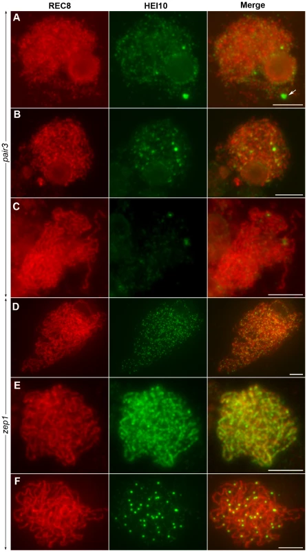 The localization of HEI10 in <i>pair3</i> and <i>zep1</i> mutants.