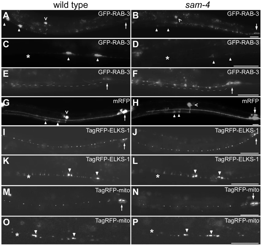 <i>sam-4(js415)</i> mutations cause abnormal accumulations of SV markers in PLM neurons.