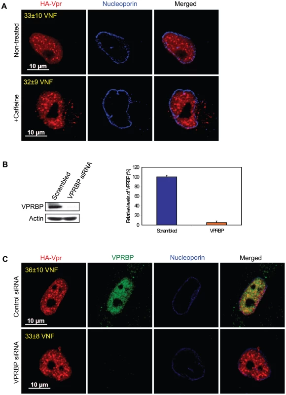 Formation of Vpr nuclear foci is independent of ATR activation and of the recruitment of VPRBP.