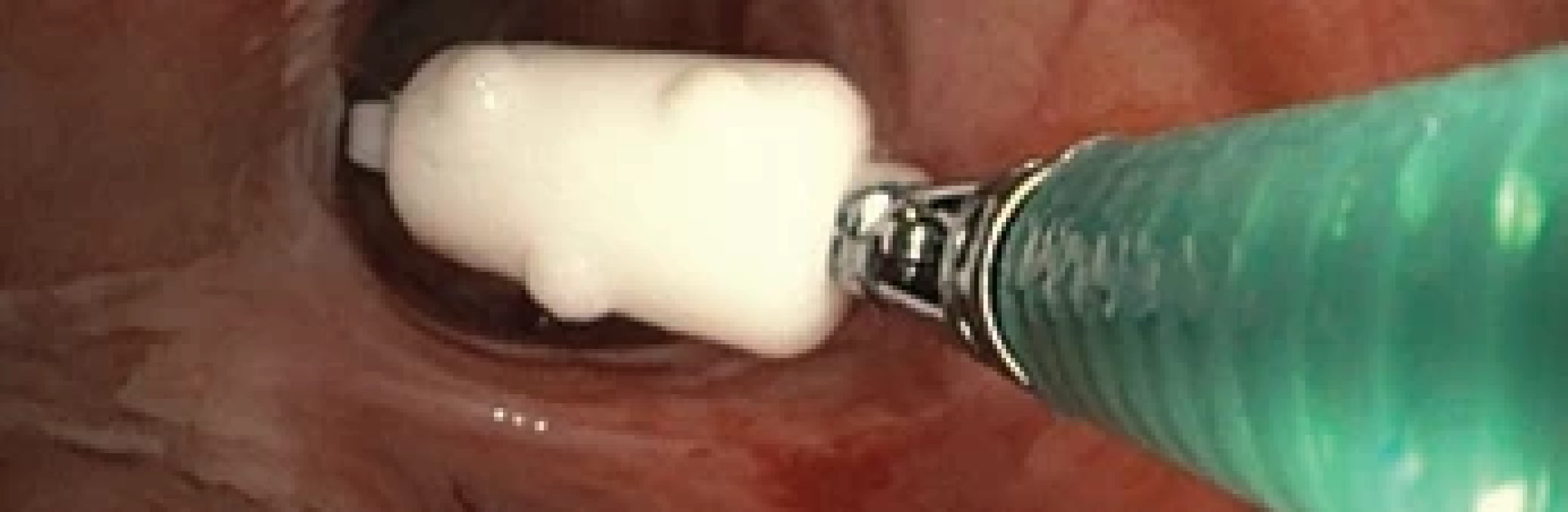 Watanabeho spigot.