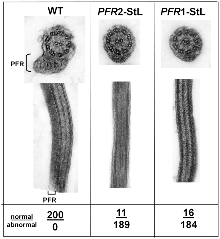 Ablation of paraflagellar rod synthesis following RNAi of <i>PFR1</i> or <i>PFR2</i>.