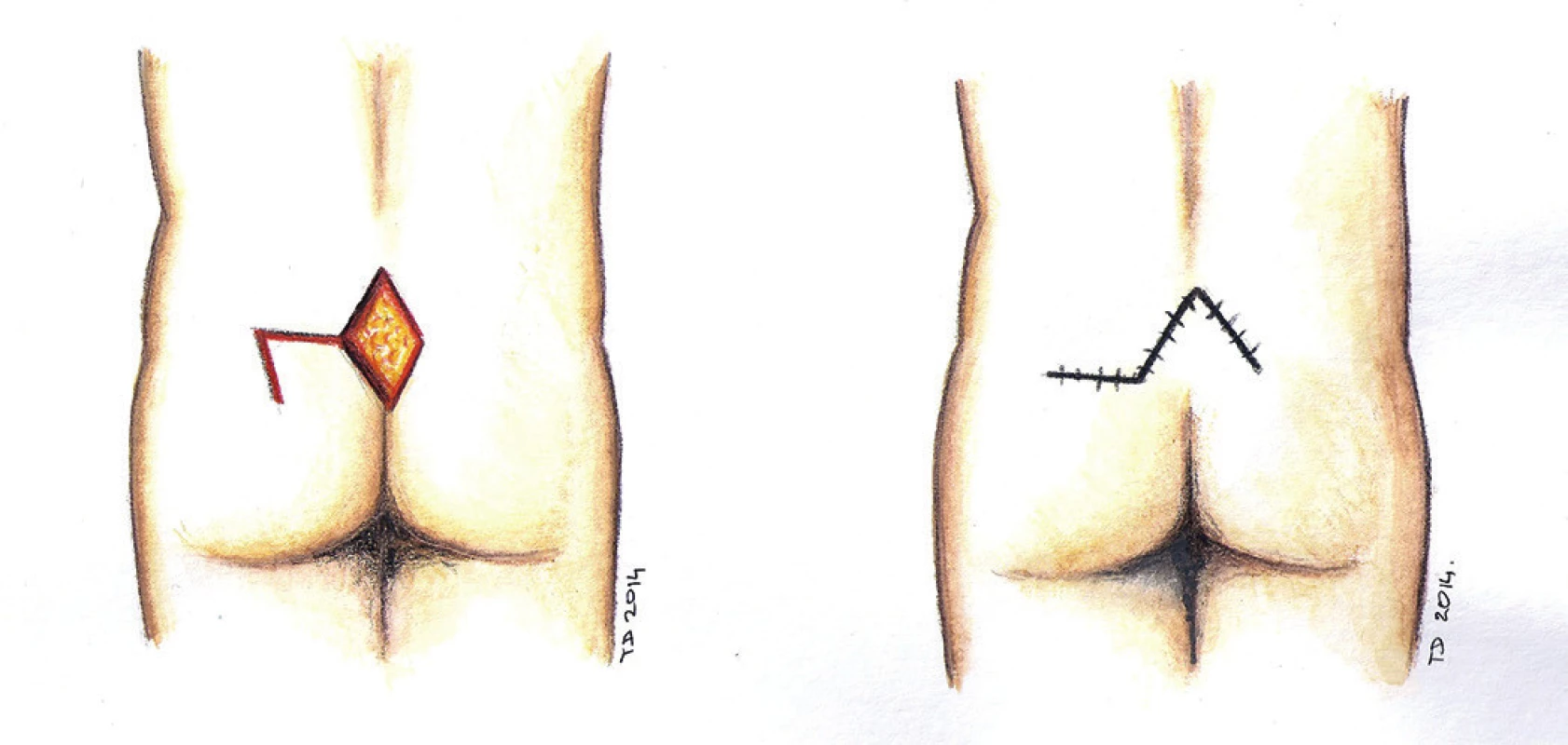 Lalok dle Limberga - schéma
Fig. 3: Limberg flap- scheme