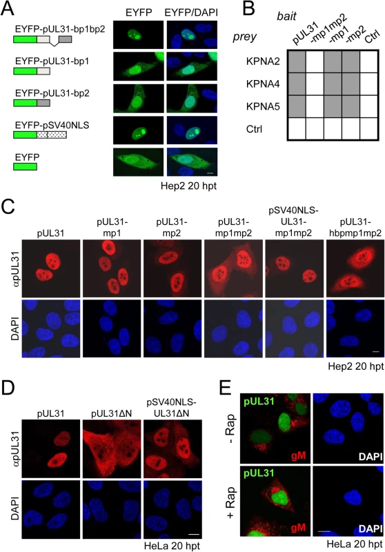 The N-terminal domain of pUL31 contains a classical bipartite NLS.