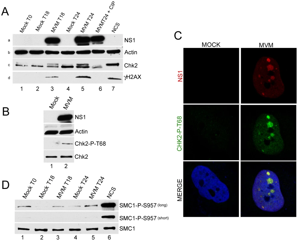 Chk2 but not SMC1 was activated during MVM infection.