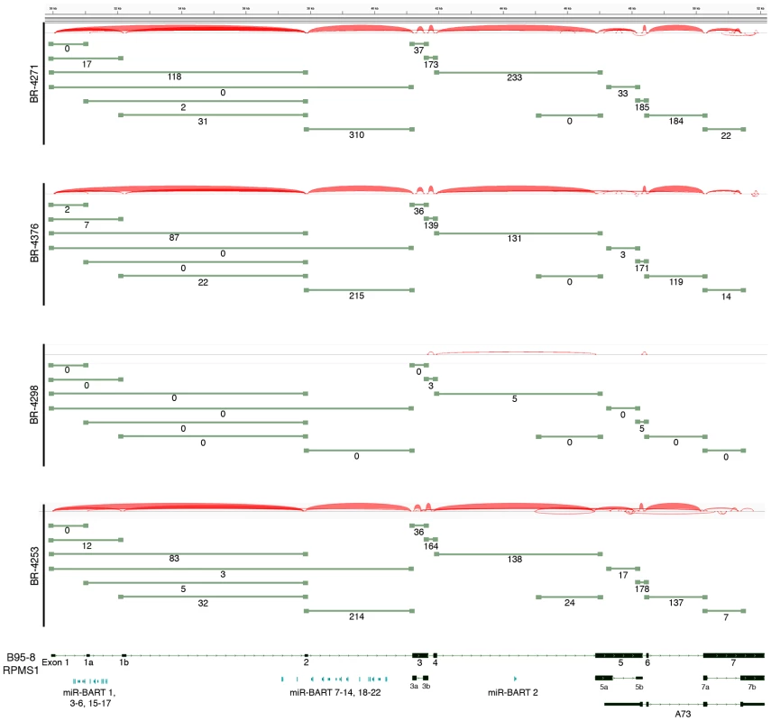 Alternative splicing in the EBV BamH1 A region in EBVaGCs.