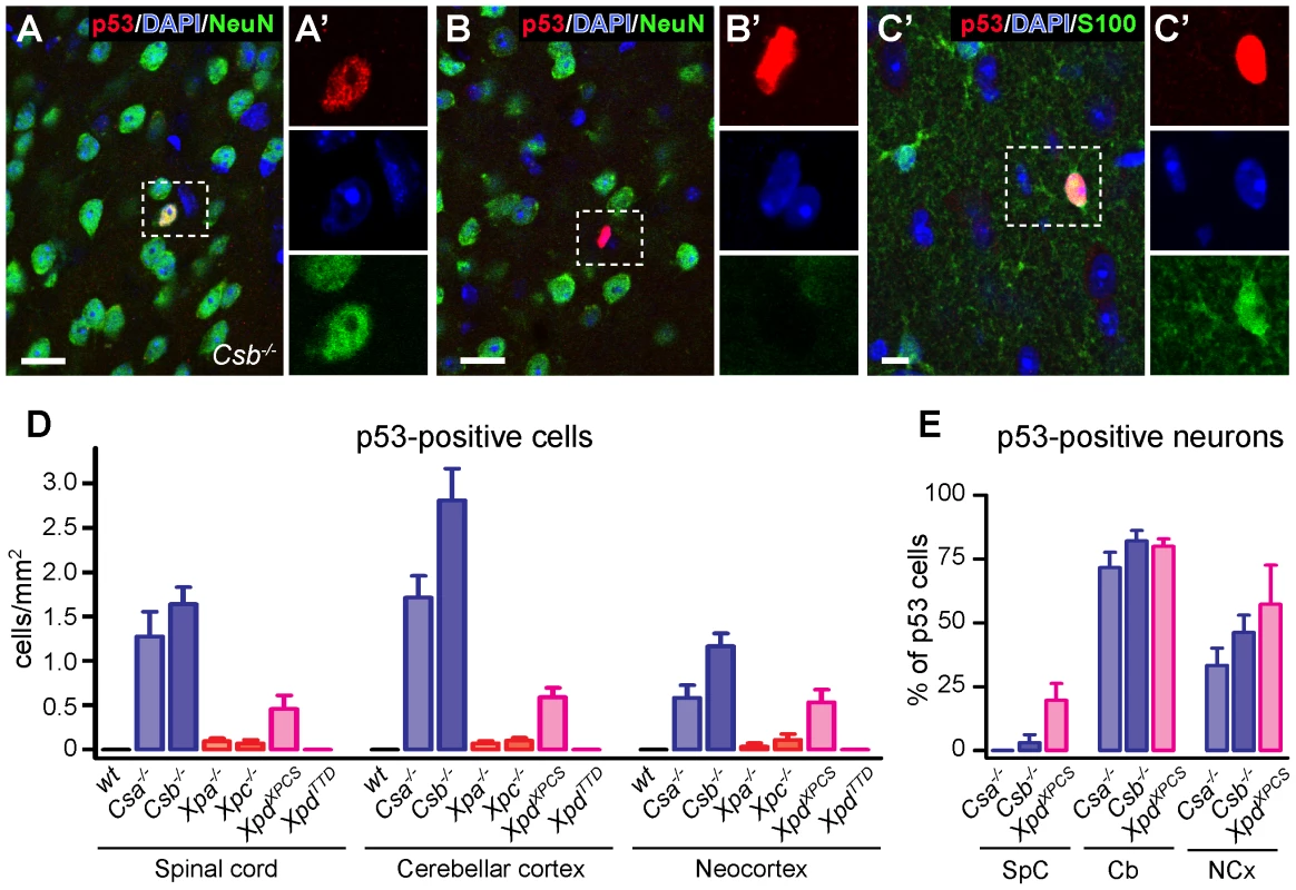p53 expression in brain and spinal cord of adult NER– and TCR–deficient mice.