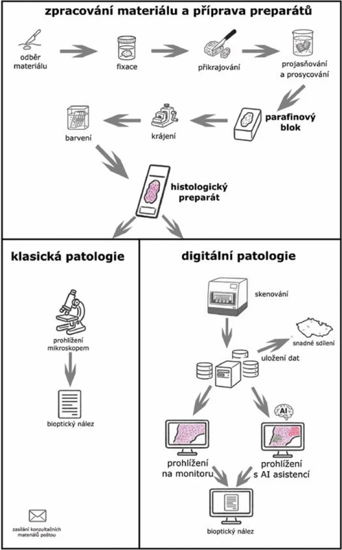 Schéma znázorňuje postup zpracování vzorků a rozdíl v práci s preparáty v rámci klasické a digitální patologie