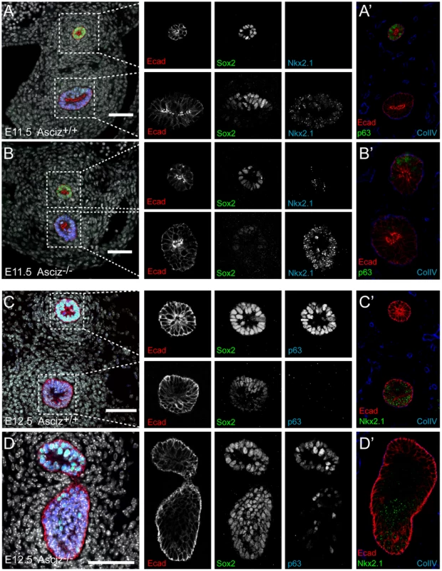 Expression analysis of markers of foregut development.