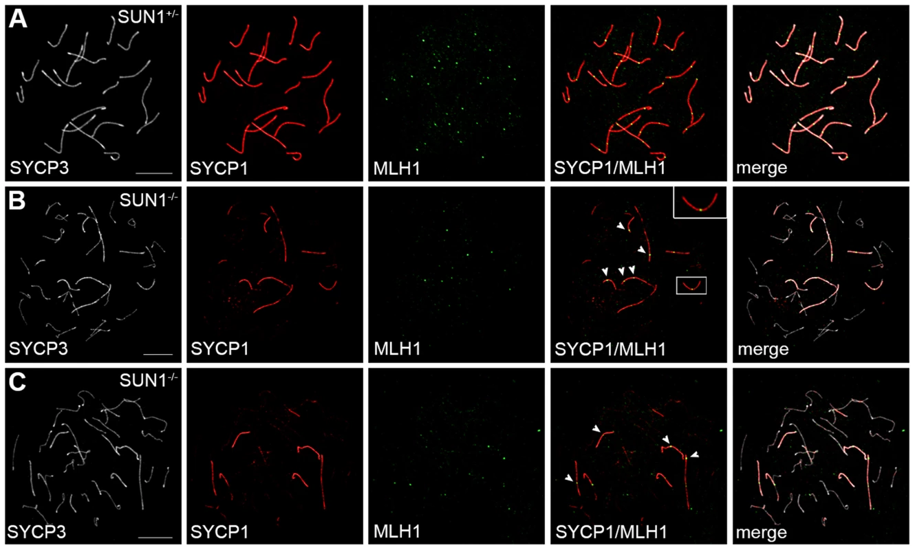 Meiotic recombination in SUN1 deficient oocytes.