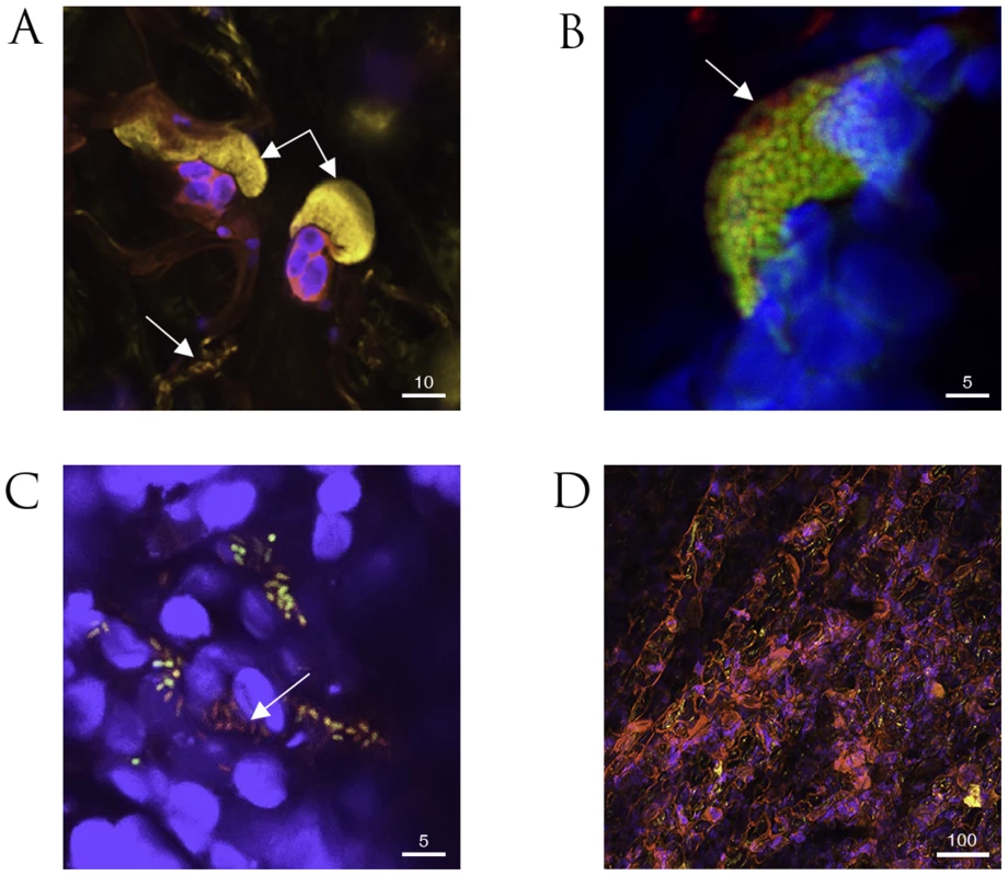 Confocal microscopy of fluorescently labeled <i>P. syringae</i> pv. <i>phaseolicola</i> 1302A strains in bean leaf tissue.