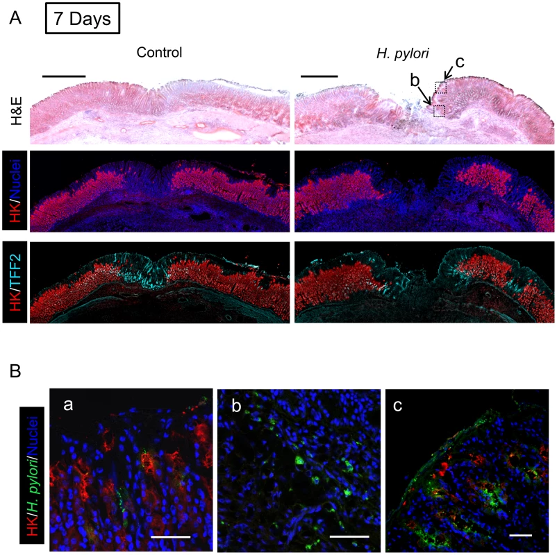 Morphology of gastric ulcerated tissue 7 days after <i>H. pylori</i> inoculation.