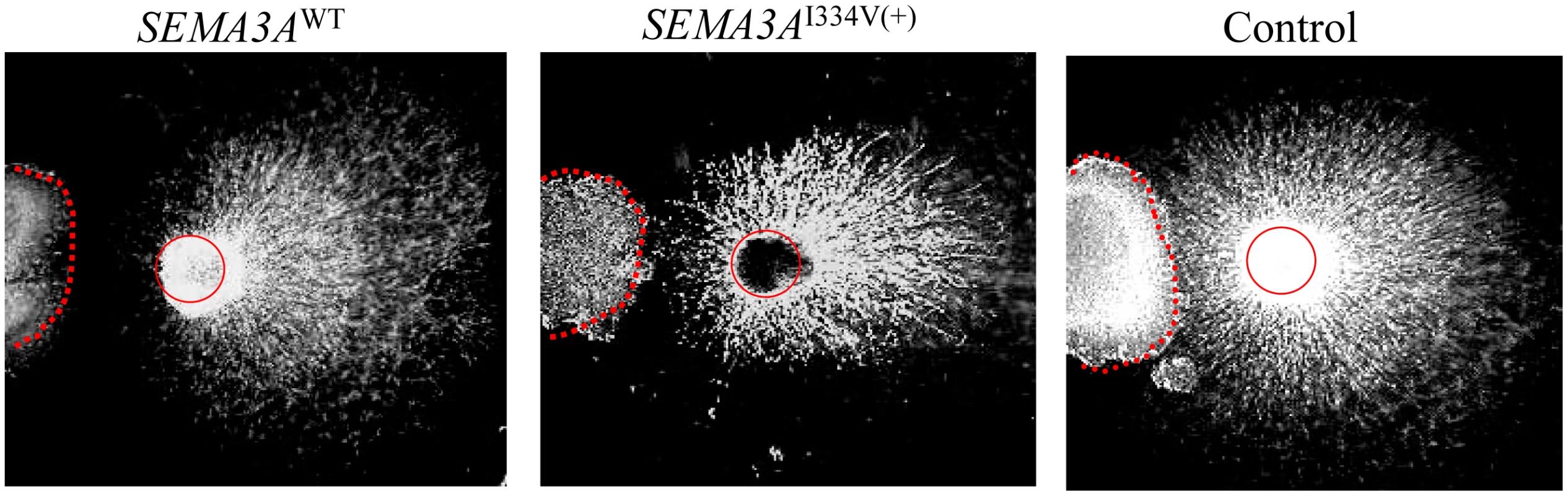 DRG repulsion assay of the <i>SEMA3A</i><sup>WT</sup>, <i>SEMA3A</i><sup>I334V</sup>, or control.