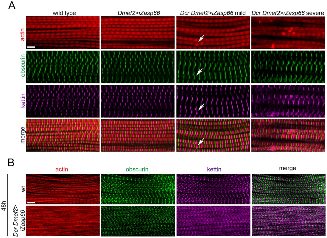Zasp66 depletion affects adult IFM structure and pupal myofibril development.