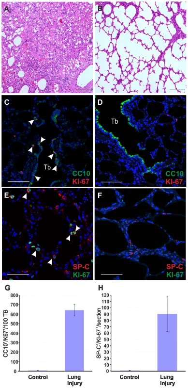Mild lung injury model in adult sheep.