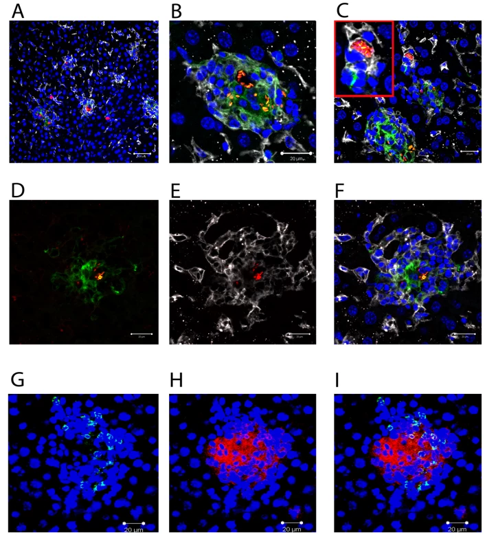 Distribution of <i>Leishmania</i> amastigotes in the liver.
