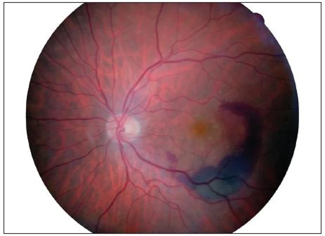Fundus OS březen 2009