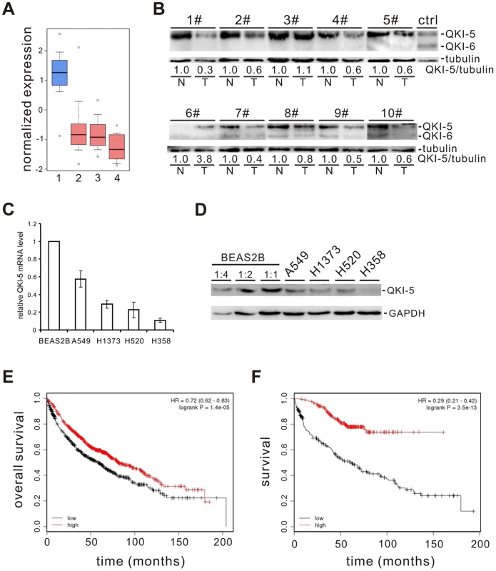 QKI is frequently down-regulated in lung cancer and associated with poorer cancer prognosis.