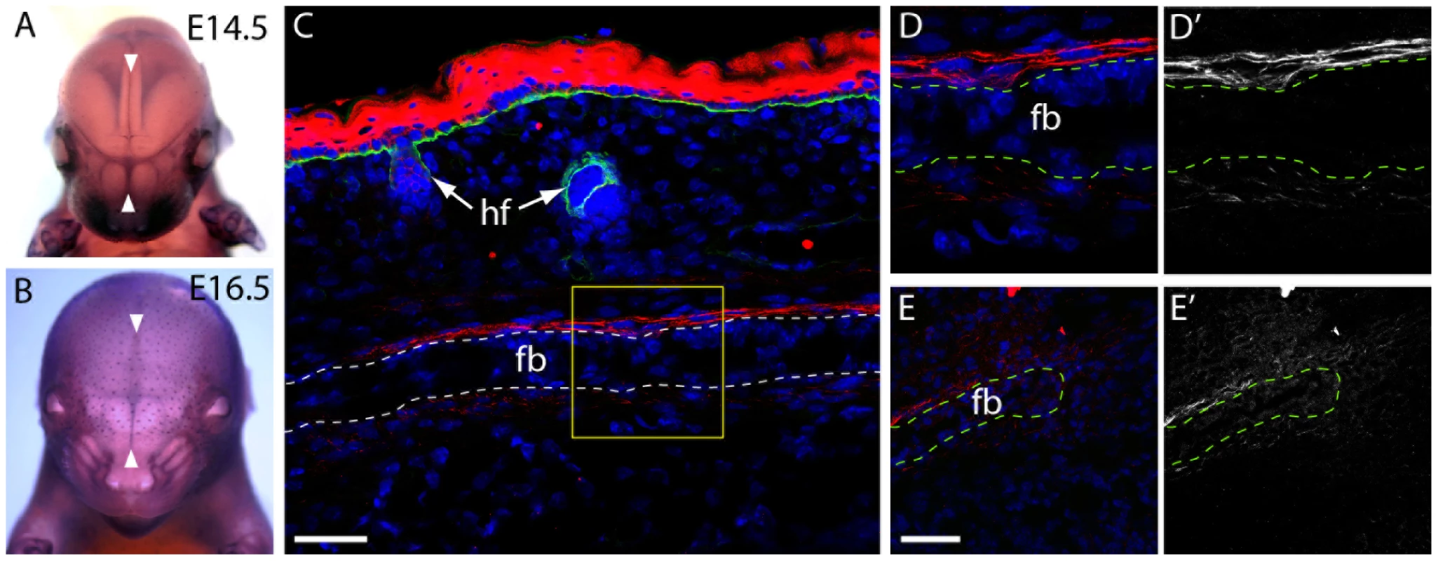 <i>Frem1</i> expression in the developing frontal and nasal sutures in mice.