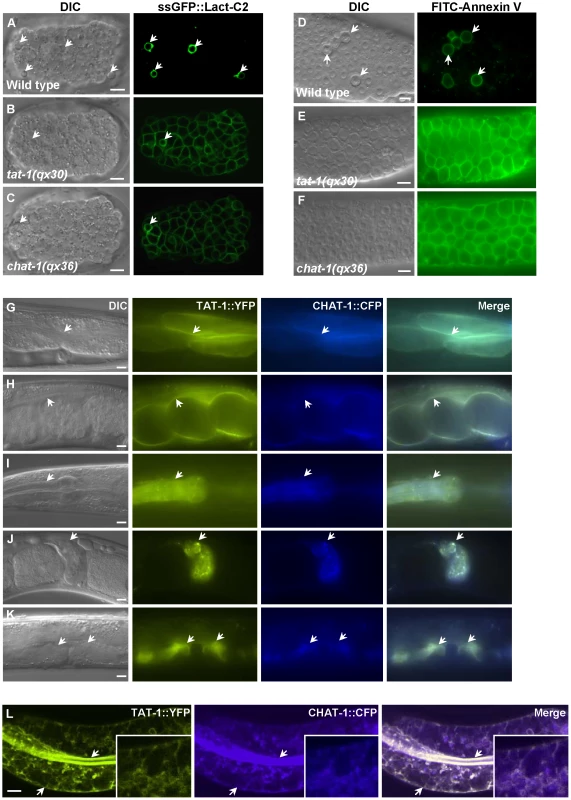 CHAT-1 and TAT-1 regulate plasma membrane PS asymmetry and express in the same tissues.