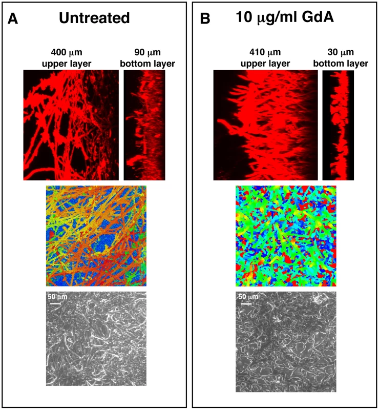 Pharmacological inhibition of Hsp90 alters <i>C. albicans</i> biofilms architecture.