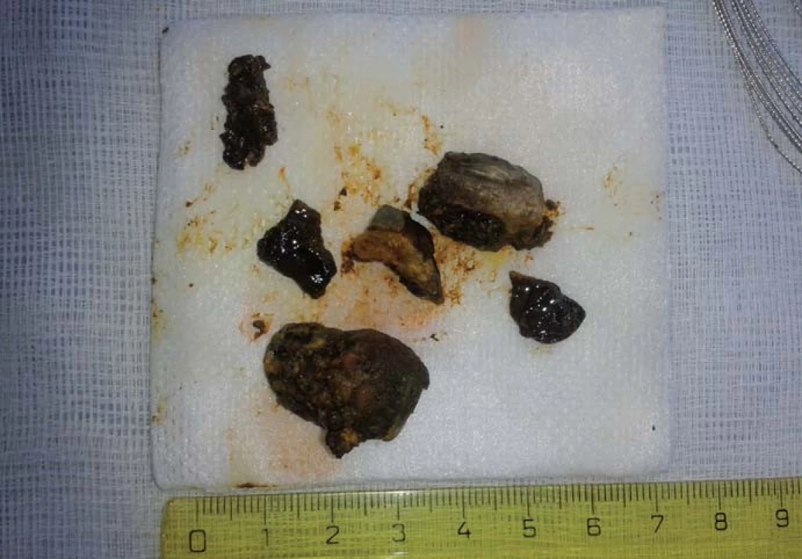 Fragmenty konkrementu.
Fig. 4. Fragments of the concrement.