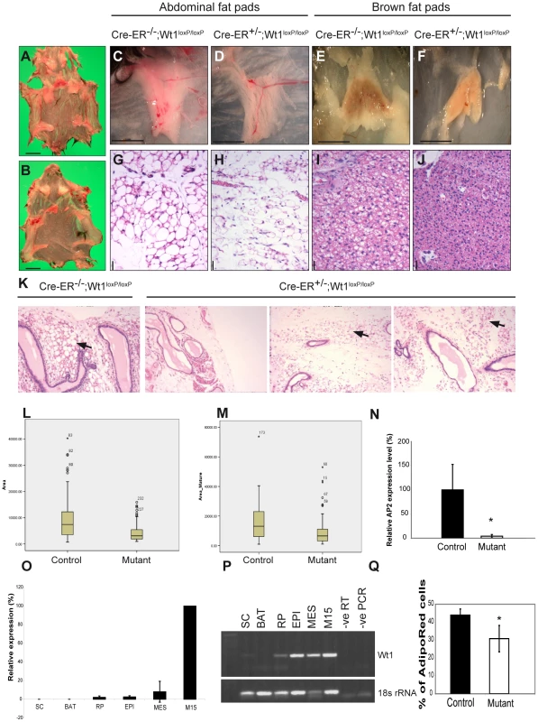 Fat reduction following Wt1 deletion.