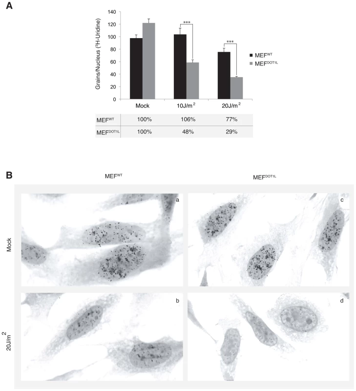 Deficient transcription recovery after UV irradiation in the absence of DOT1L.