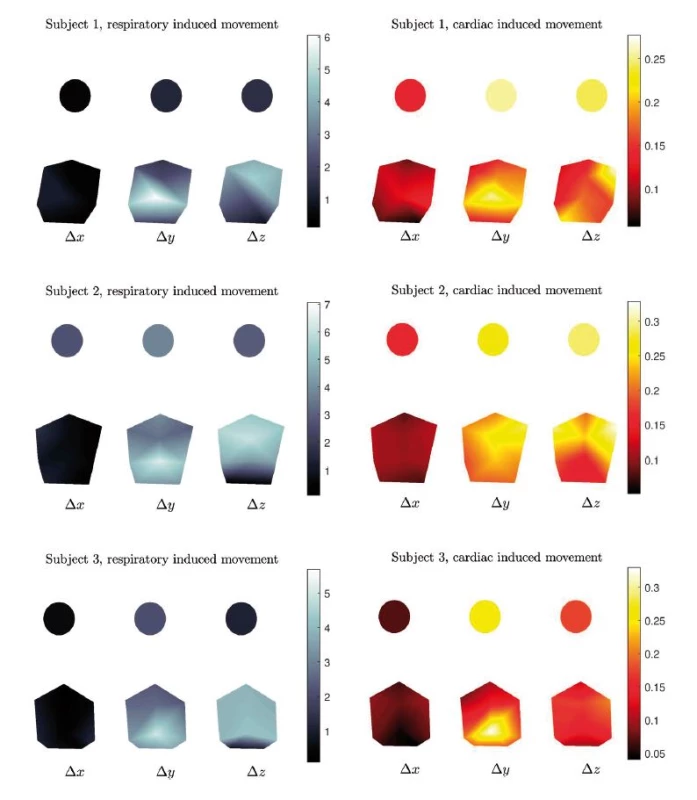 Mapping of respiratory (left) and cardiac (right) induced movement, see also Fig. 5. For each subject, an individual color code was used for respiratory and cardiac movement, which was constant for x, y, and z component. Values are given in mm.