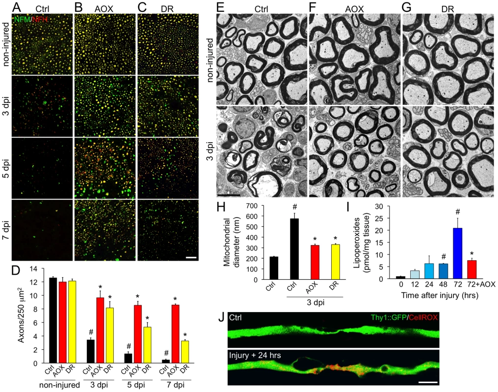 Systemic antioxidant treatment and intermittent fasting delay axonal degeneration in mice.