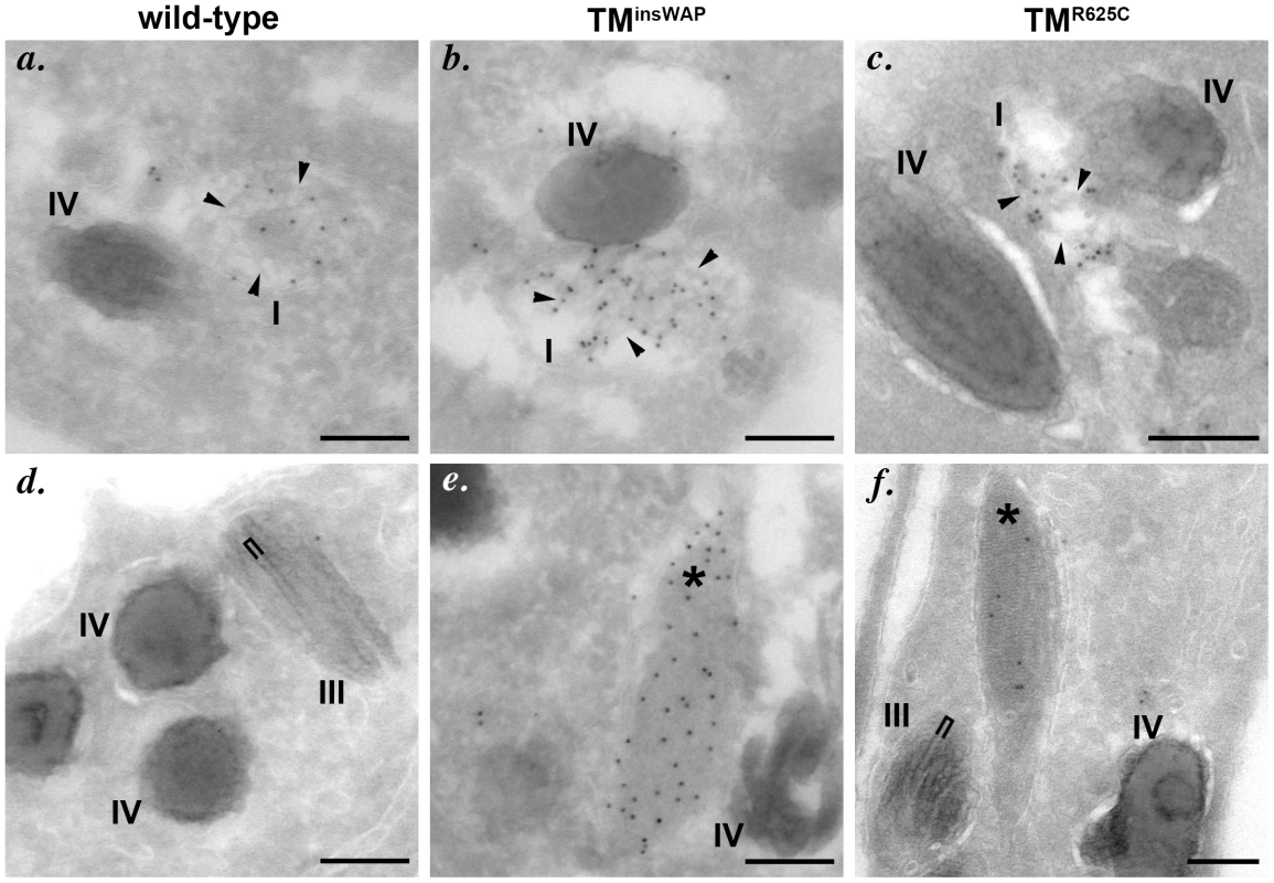 PMEL TMD mutants generate fibrils with aberrant morphology.
