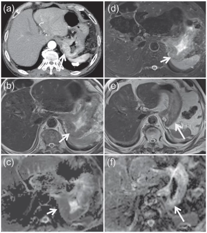 CT and MRI findings.