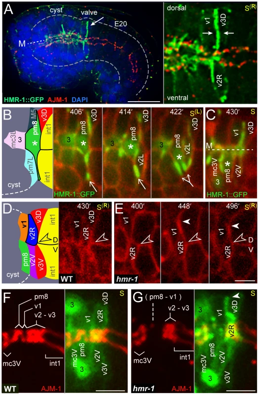 HMR-1/E-cadherin expression and circumferential intercalations.