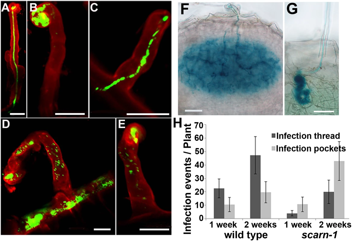 Infection thread phenotype of the <i>scarn-1</i> mutant (SL2564-3).