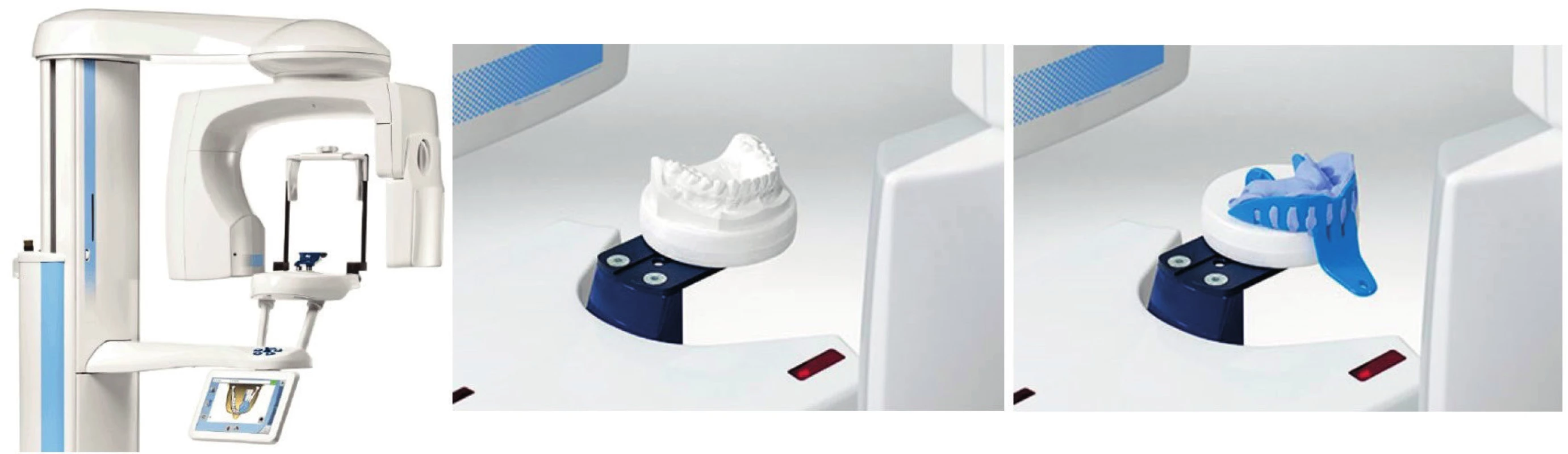 Objemová data získaná digitalizací pomocí počítačové tomografie na přístroji Planmeca ProMax<sup>®</sup> 3D (Planmeca, Finsko) (převzato z: <a href="http://www.midealtech.com.tw/eng/p2-products-1a.htm">www.midealtech.com.tw/eng/p2-products-1a.htm</a>).