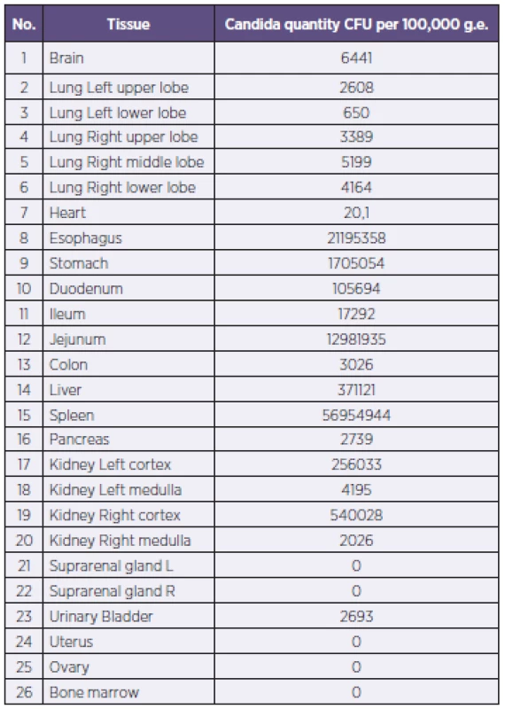 Candida DNA quantity in tissues
Tabulka 1. Nálož kvasinkové DNA ve tkáních