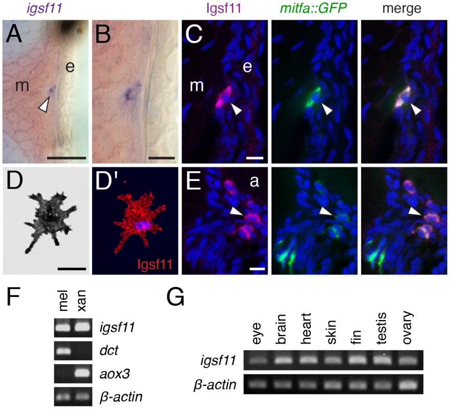 <i>igsf11</i> is expressed by pigment cells and their precursors.