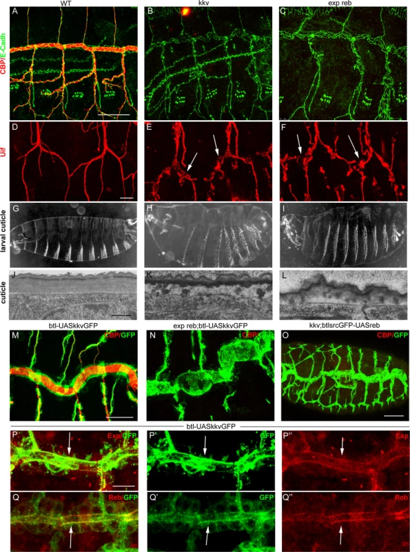 Analysis of <i>exp reb</i> and <i>kkv</i> phenotypes, epistatic interactions, and subcellular accumulation.