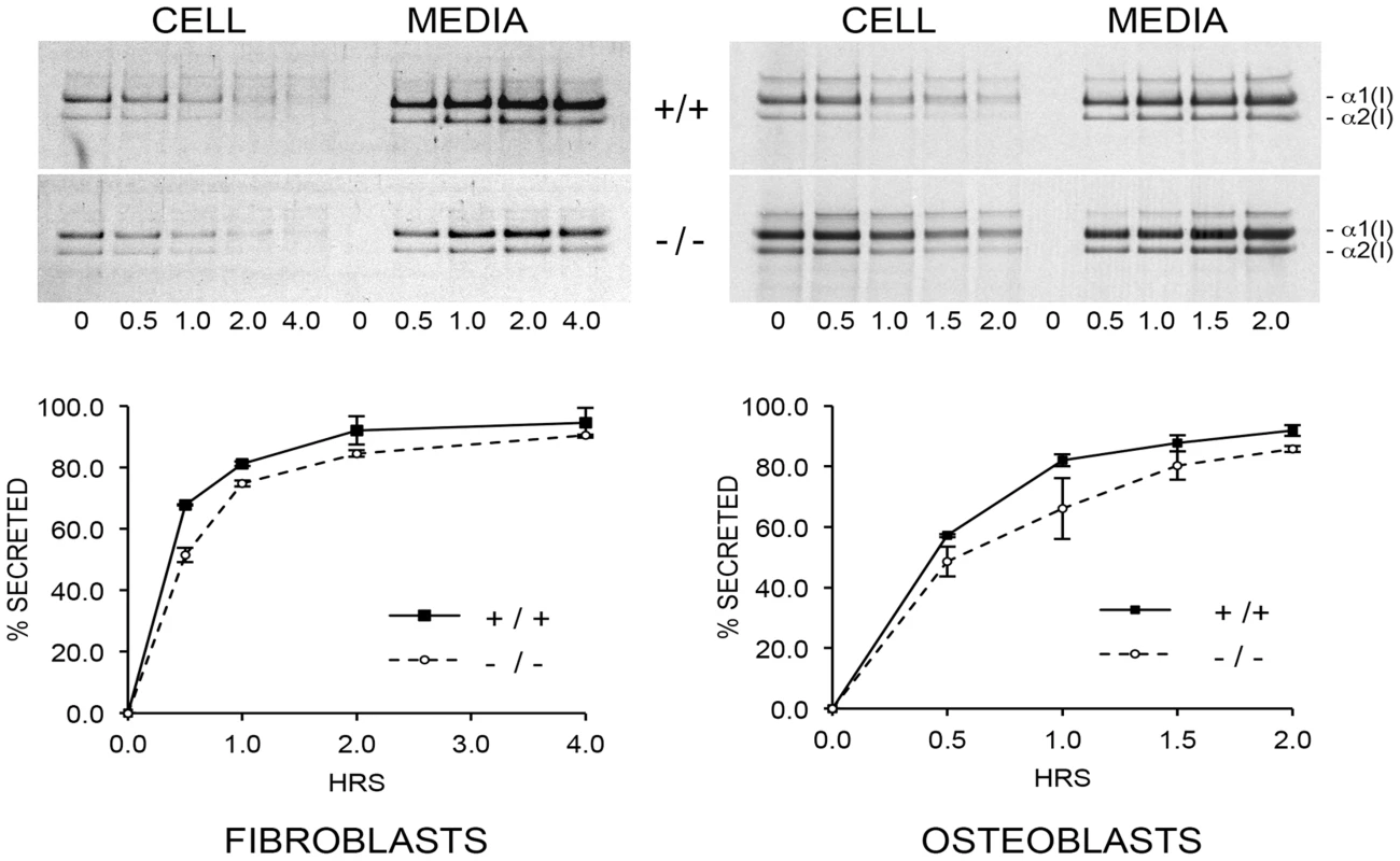 Pulse-chase analysis of type I collagen secretion.