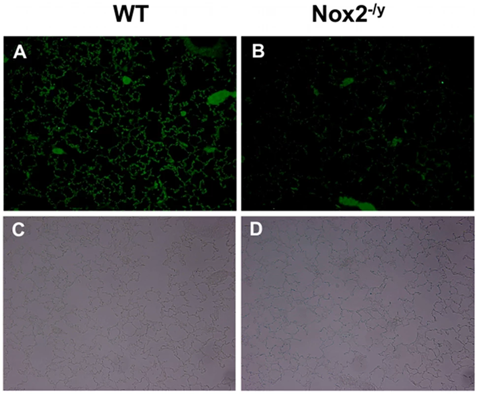 Cleaved caspase 3 immunofluorescence to assess lung alveolar epithelial apoptosis.