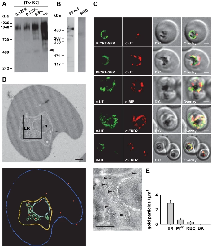 HECT ubiquitin-protein ligase (PfUT) localizes to the ER/Golgi complex.