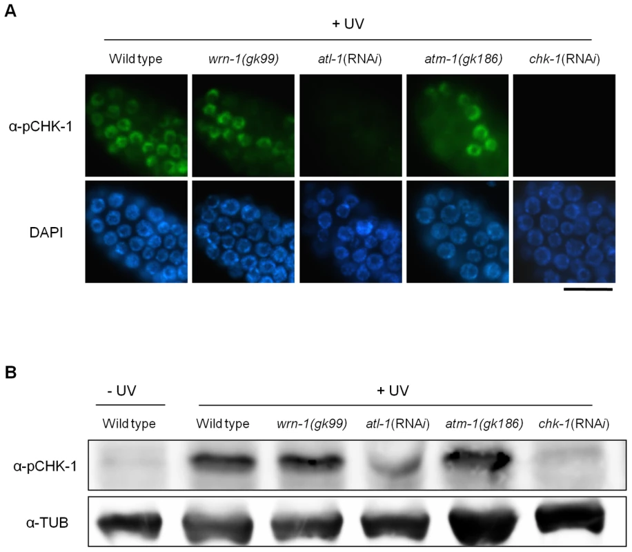 The <i>wrn-1</i> mutation does not affect the phosphorylation of CHK-1(S345) after UV-irradiation.