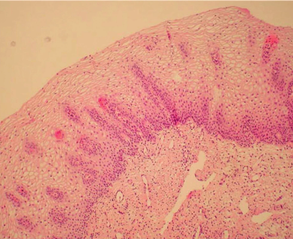 Normální cervikální epitel (HE – hematoxylin eozin)