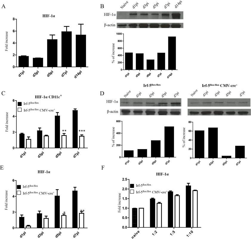 <i>L</i>. <i>donovani</i> infection induces HIF-1α expression in CD11c<sup>hi</sup> splenic DCs in an IRF-5 dependent manner.