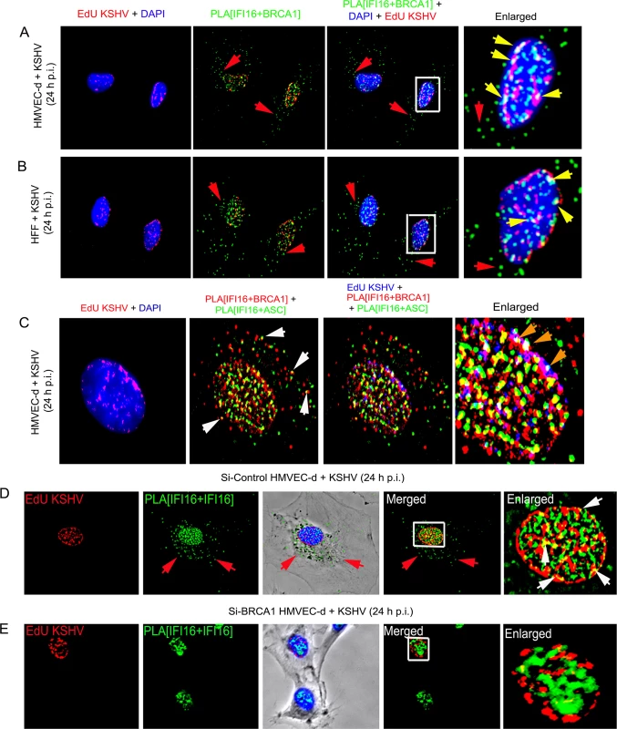 Analysis demonstrating that BRCA1 is involved in the recognition of KSHV genomes by IFI16.
