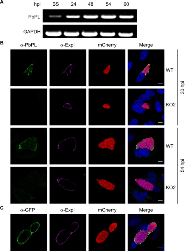 PbPL is expressed throughout liver stage development and localizes to the PVM.