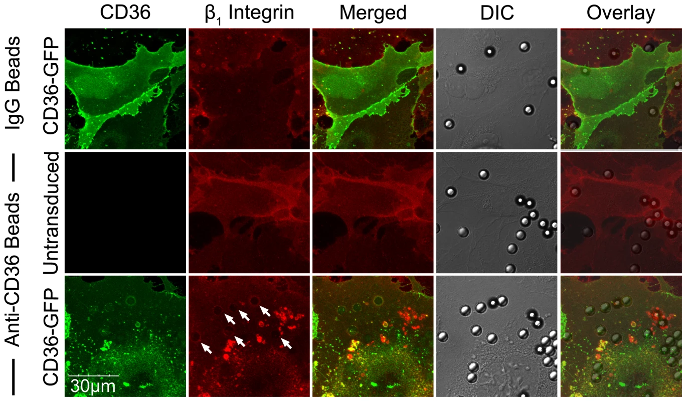 β<sub>1</sub> integrin recruitment by adherent anti-CD36 coated beads on HMEC-1.