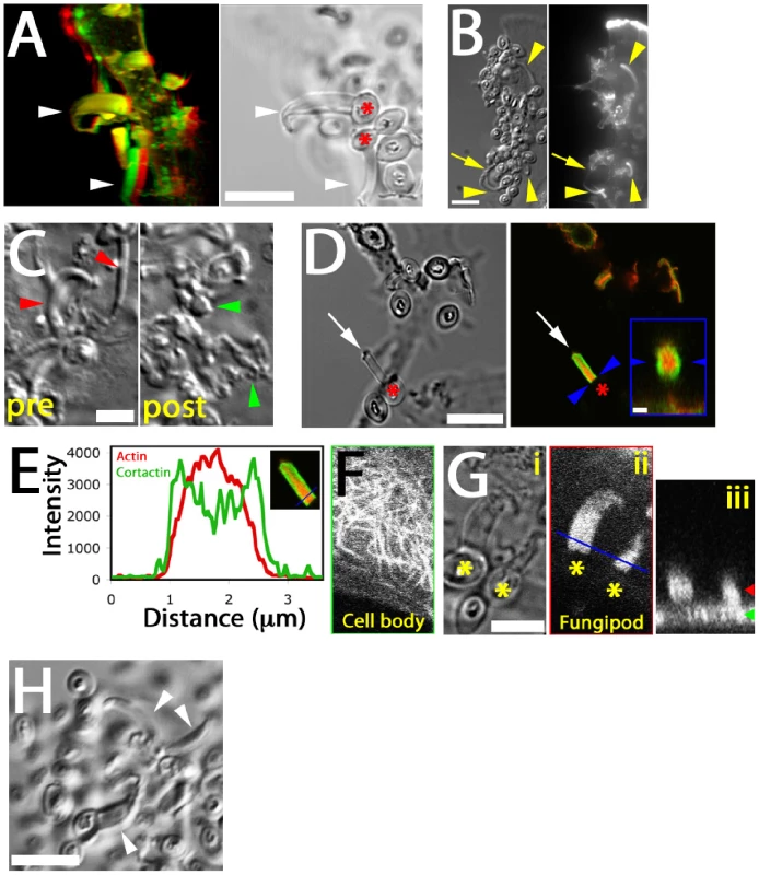 Cytoskeletal structure of fungipods.